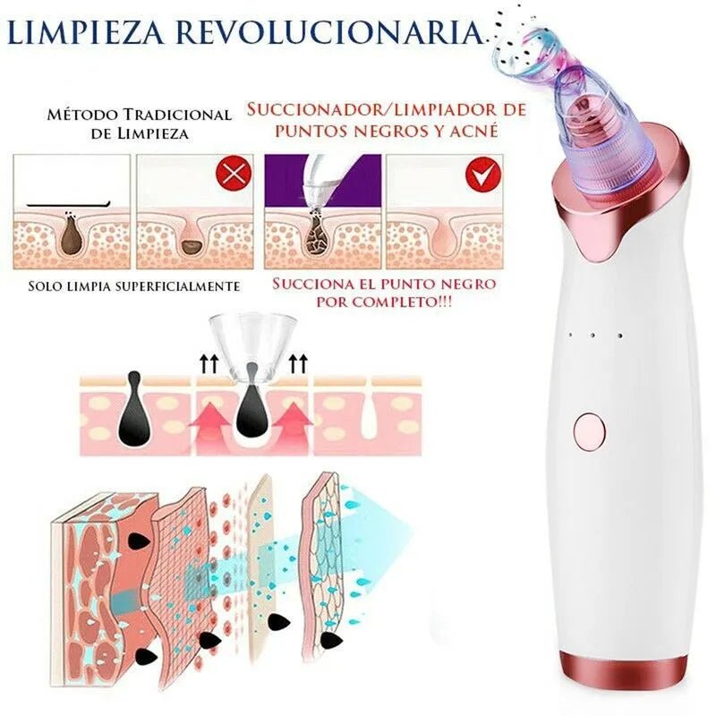 PoreClean Pro® – ¡Adiós a los puntos negros! Limpieza facial profunda en casa 🧼✨ 2X1