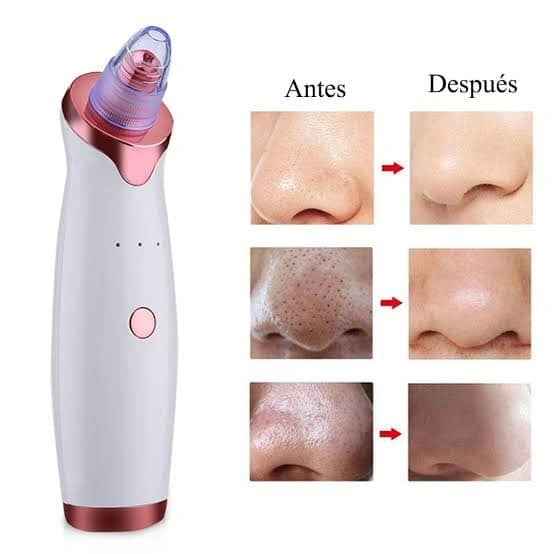 PoreClean Pro® – ¡Adiós a los puntos negros! Limpieza facial profunda en casa 🧼✨ 2X1