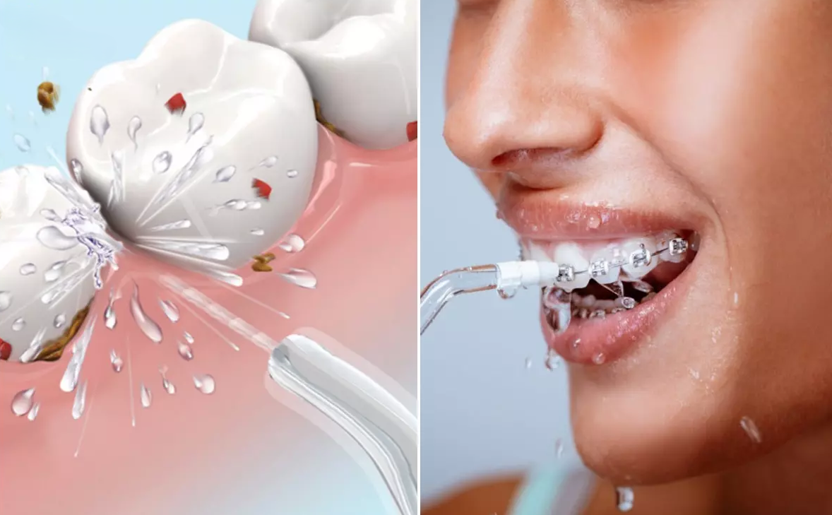 🦷✨ Combo Sonrisa Perfecta – ¡Limpieza Bucal Completa desde Casa!